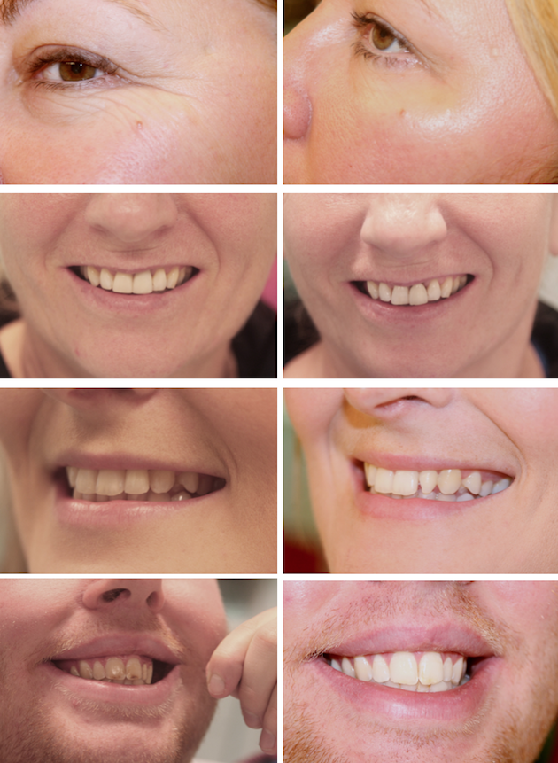 images/advert_images/teeth-whitening_files/measham new.png